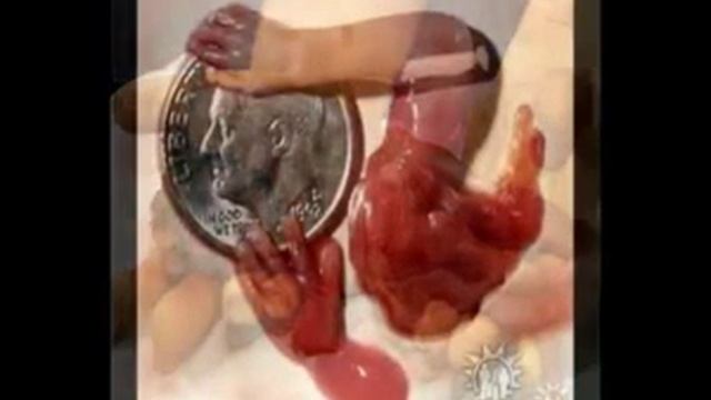 Как вовлечь православных христиан в антиабортную деятельность ? смотреть онлайн