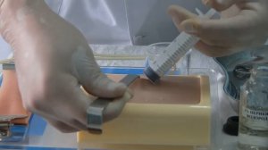 Алгоритм перевязки гнойной раны.