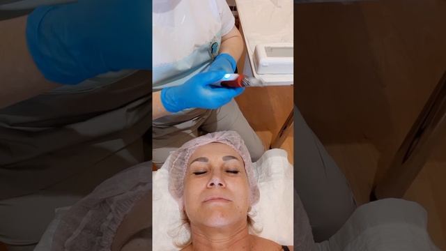 ФРАКЦИОННАЯ МЕЗОТЕРАПИЯ