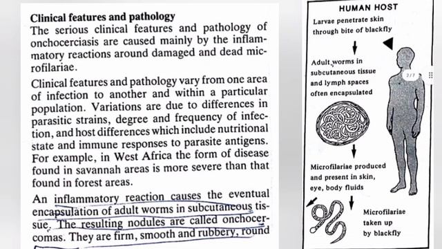 Onchocerca volvolus (River blindness) Parasitology lectures series by Prof Dr Abdul Qadar khan смотреть онлайн