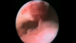 Что такое овуляция и как происходит