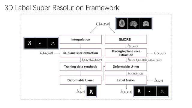 Label super resolution for 3D Magnetic Resonance Images using Deformable U-net | SPIE 2021 смотреть онлайн
