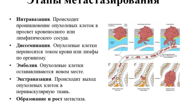 13:50 Общее понятие об опухолях. Эпителиальные опухоли. Раки отдельных органов смотреть онлайн
