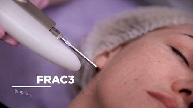 4D омоложение лица на лазере Fotona | Как проходит процедура | Клиника Vidnova смотреть онлайн