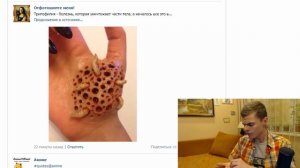 Трипофобия   Трипофилия Гугл Картинки №19