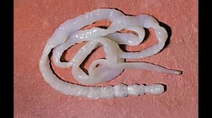 Признаки и симптомы цепней в организме человека