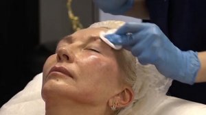 PDRN Booster  Проработка грыж, маляров. Лифтинг и контуринг лиц. Протокол работы