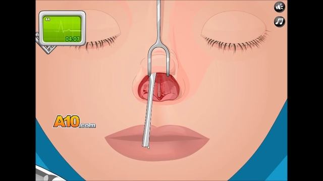 Operate Now: Nose Surgery - Walkthrough смотреть онлайн