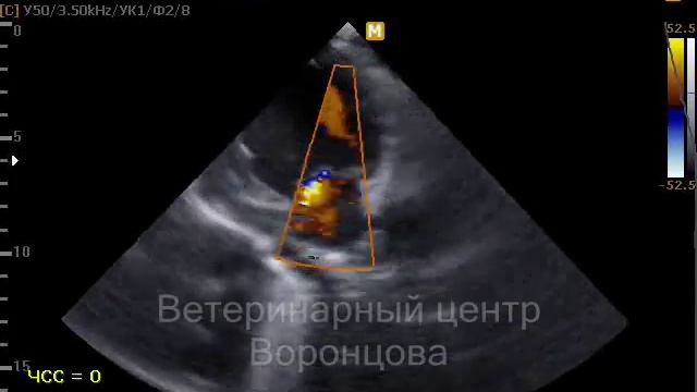 Недостаточность митрального клапана смотреть онлайн
