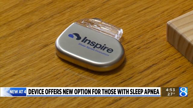 New internal device helps with sleep apnea смотреть онлайн