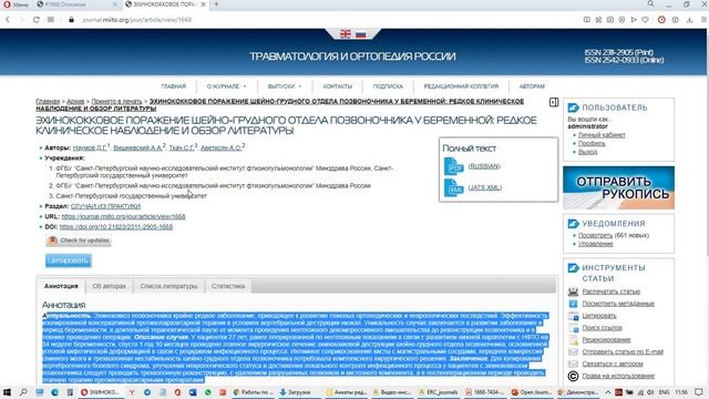OJS RUS - ИНСТРУКЦИЯ ДЛЯ РЕДАКТОРА. Занятие 25. Публикация в Online First смотреть онлайн