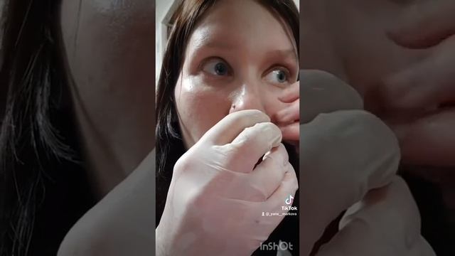 Прокол губы дома. Пирсинг губы "Мадонна" смотреть онлайн