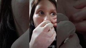Прокол губы дома. Пирсинг губы «Мадонна»