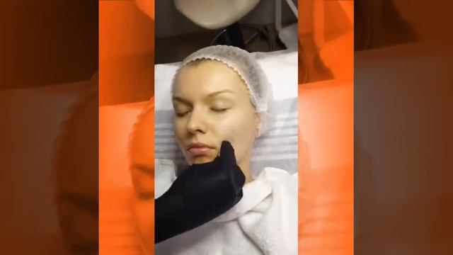 Оранжевый пилинг в Праге смотреть онлайн