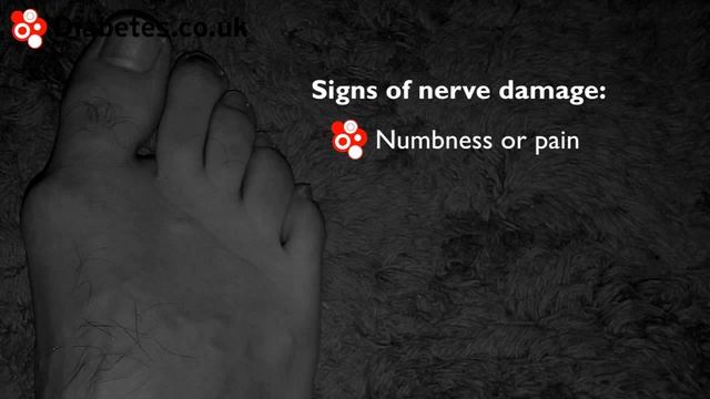 How to Check Your Feet For Signs of Nerve Damage смотреть онлайн