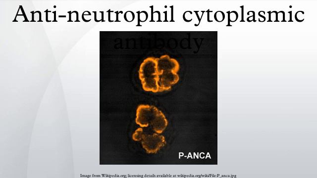 Anti-neutrophil cytoplasmic antibody смотреть онлайн