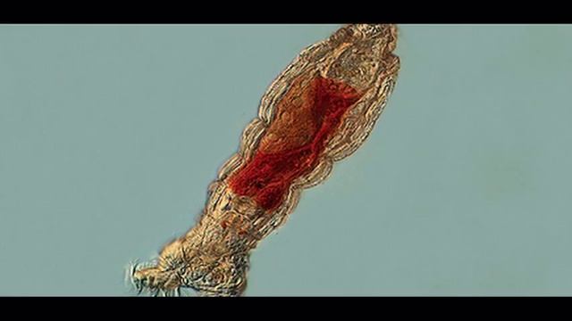 Зоопланктон реки Дунай смотреть онлайн