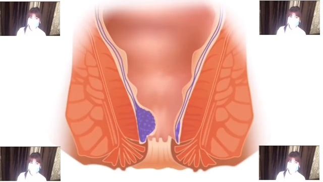 GEMAROYNI SUPER DAVOLASH USULLY