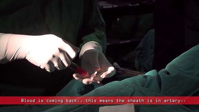 Coronary angiogram | a live demonstration смотреть онлайн