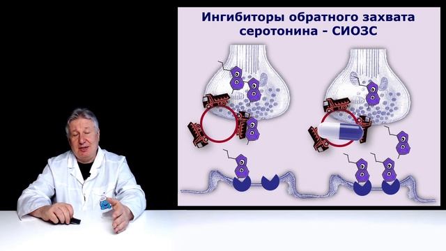 Новые подходы к лечению мигрени. Хороший пример. смотреть онлайн