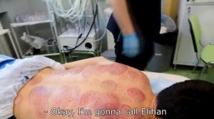 МОЩНАЯ МАНУАЛЬНАЯ ТЕРАПИЯ I МАССАЖ I ASMR I БАНКИ