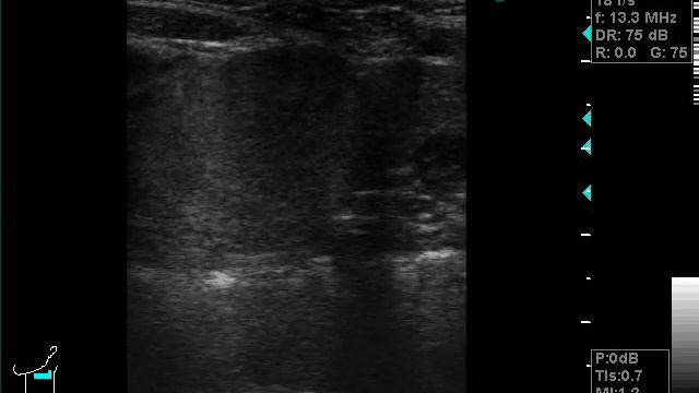 слюнная железа смотреть онлайн