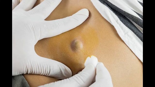 Как одеваться на прием к остеопату смотреть онлайн