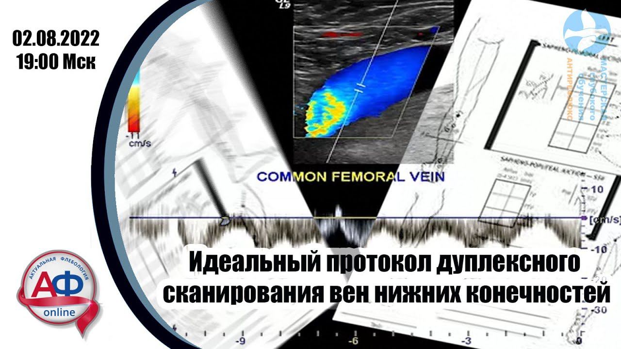 Идеальный протокол дуплексного сканирования вен нижних конечностей смотреть онлайн