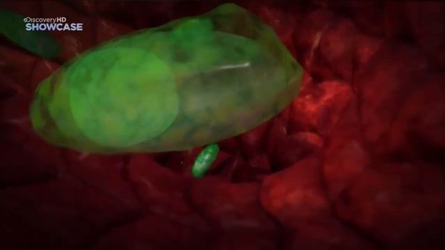 сибирская язва