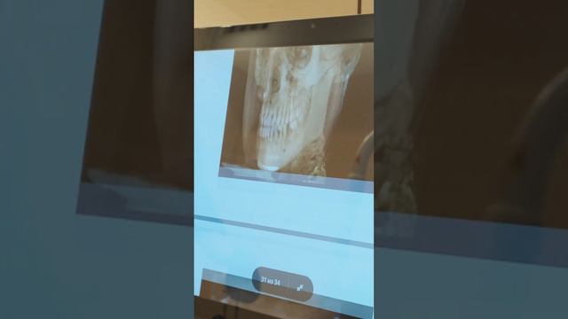 СМОТРЕТЬ ПОЛНОЕ ВИДЕО ► Https://youtu.be/ub9BSSfZQkA