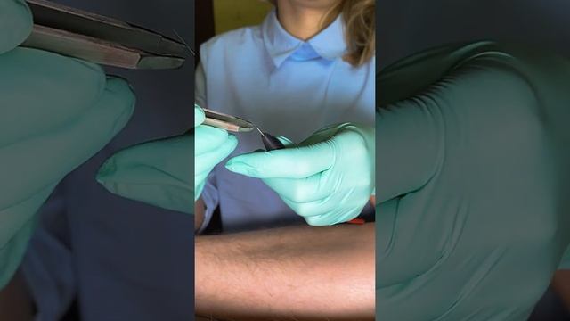 Весь процесс электроэпиляции в 60 сек смотреть онлайн