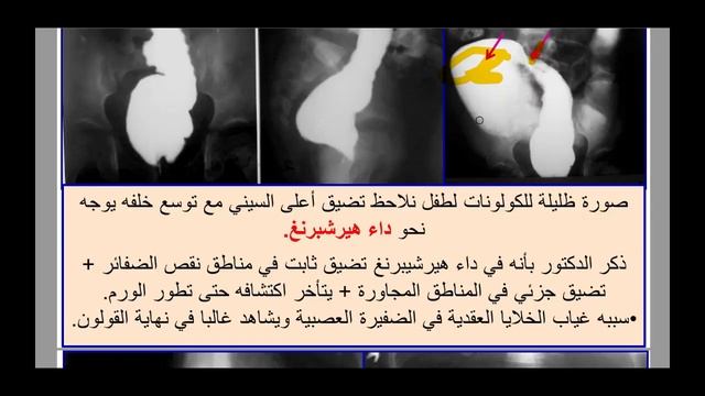مراجعة سريعة لامتحان عملي الأشعة1 -High-yield GIT imaging (Review) смотреть онлайн