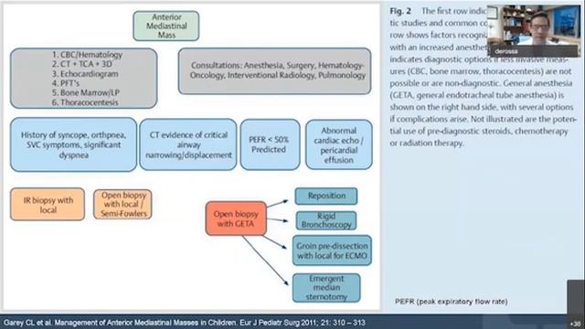 Anterior Mediastinal Mass in a 16-Year-Old смотреть онлайн