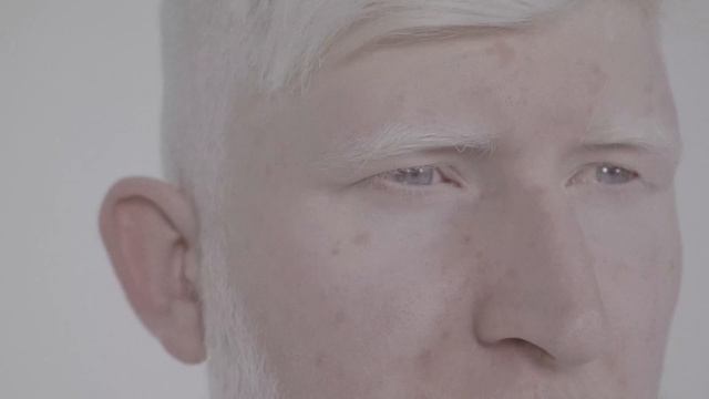 Красота – это разнообразие. Истории Лены и Жоры смотреть онлайн