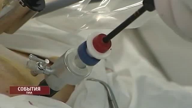 Удаление почки без разреза смотреть онлайн