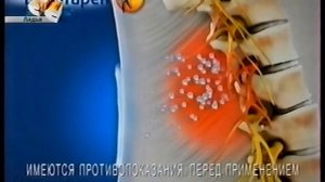 Реклама Вольтарен 2010-2011 (3) (RU)