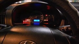 Hyundai Elantra 1.6 периодически не работает стартер.