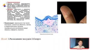 Патологическая анатомия | ВОСПАЛЕНИЕ