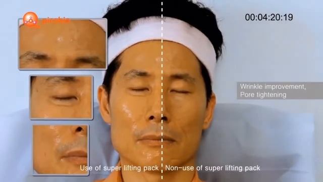 Программа Супер лифтинга от Pico Bio смотреть онлайн