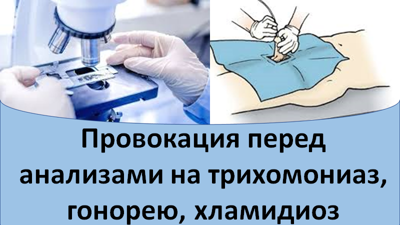 Провокация перед анализами на трихомониаз, гонорею и хламидиоз смотреть онлайн