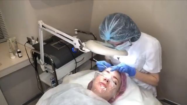 Процедура комплексной чистки лица смотреть онлайн