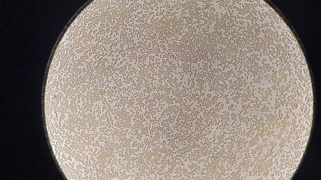 Влияние арбуза на кровь смотреть онлайн