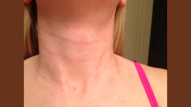 К чему чешется шея? Толкование приметы для женщин и мужчин смотреть онлайн