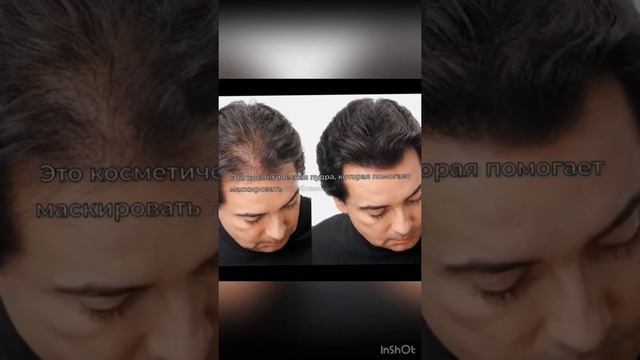 Как скрыть облысение мужчине? смотреть онлайн