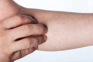 Васкулит. Почему воспаляются сосуды? Сосудистый хирург, флеболог Дмитрий Некрасов.