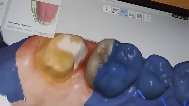3D Scan of part of my mouth using Medit i700 scanner. смотреть онлайн