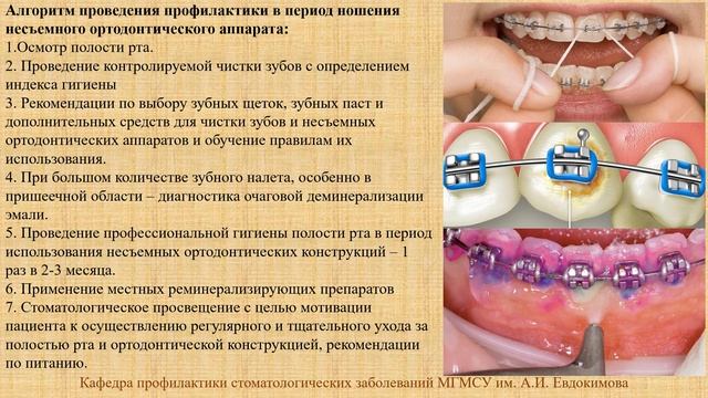 Общие методы профилактики кариеса зубов (практическое занятие) смотреть онлайн