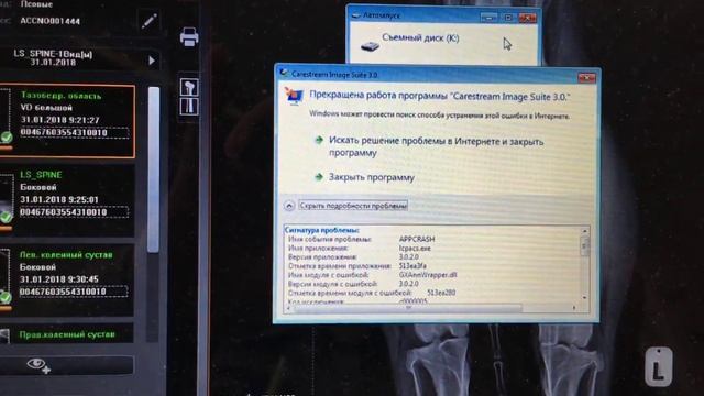 Ошибки программы Image Suite Carestream смотреть онлайн