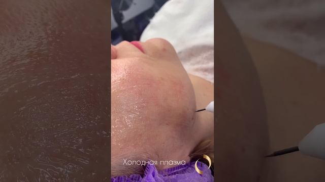 Холодная плазма смотреть онлайн