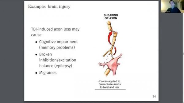 Lecture 10. Networks in brain (Computational Neuroscience Course)